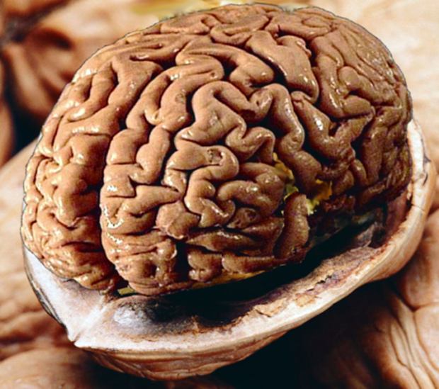 cerebro.jpg