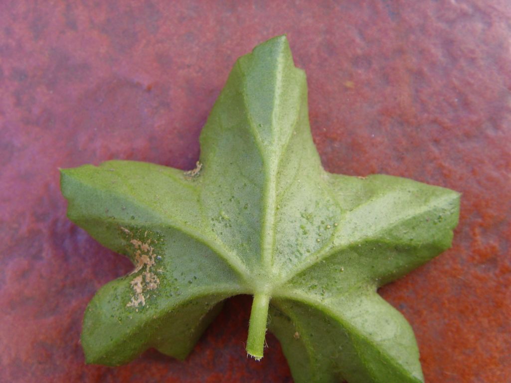 edema1.jpg