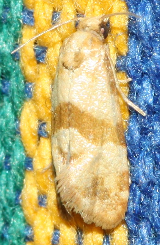 microlep4hoag.jpg