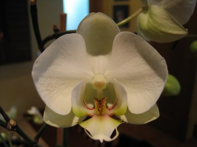 normal_MI%20PHAL.jpg