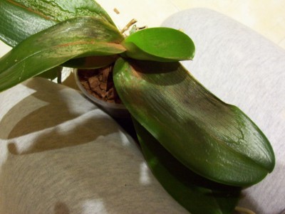 normal_Phal%203.jpg