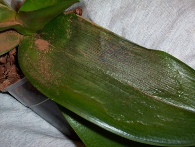 normal_phal%205.jpg