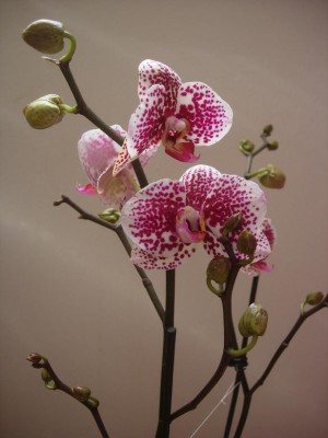 normal_phal.JPG