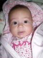 galis